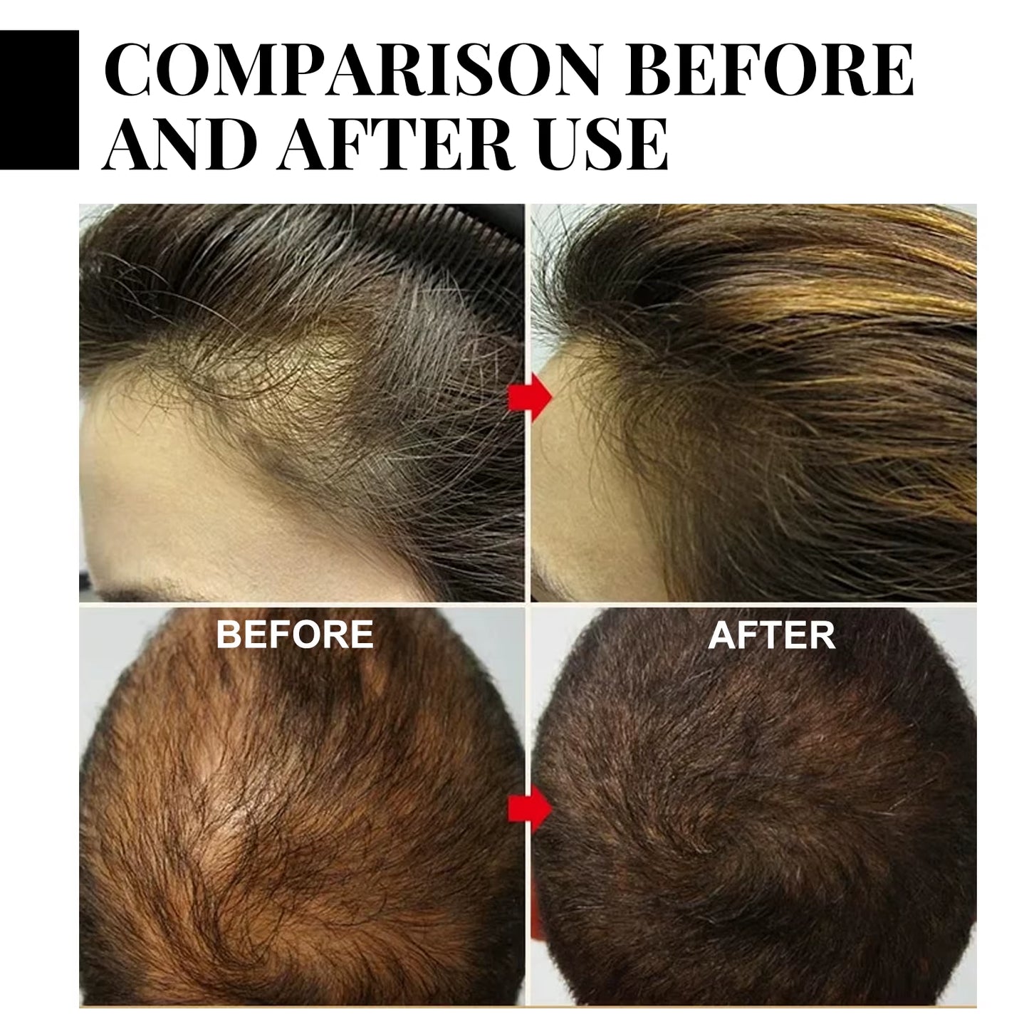 Jaysuing Natural Batana Oil Hair Spray anti Hair Loss Hair Care Promotes Hair Growth Suitable for Men and Women Hair Conditioner