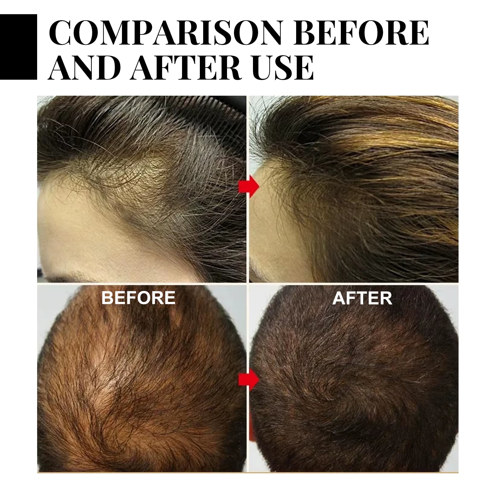 Jaysuing Natural Batana Oil Hair Spray anti Hair Loss Hair Care Promotes Hair Growth Suitable for Men and Women Hair Conditioner